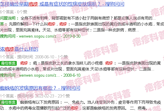 汕头男性疱疹的高清图片