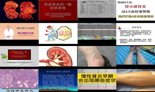 汕头肾炎症状