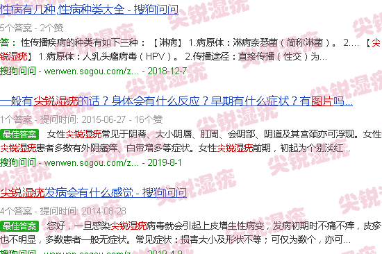 汕头包皮尖锐湿疣图片