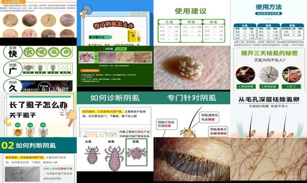 汕头去阴虱*简单的方法