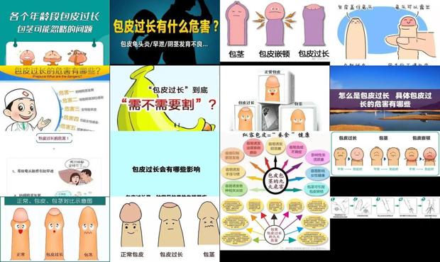 汕头包皮过长会影响性生活