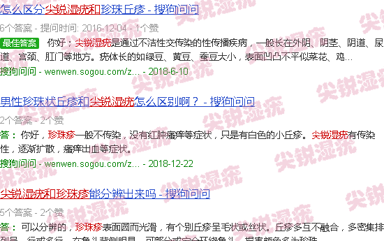 汕头尖锐湿疣和珍珠疹图片对比