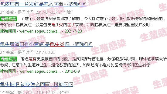 汕头有龟头炎症状图片
