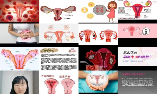 汕头子宫性出血会导致不孕吗