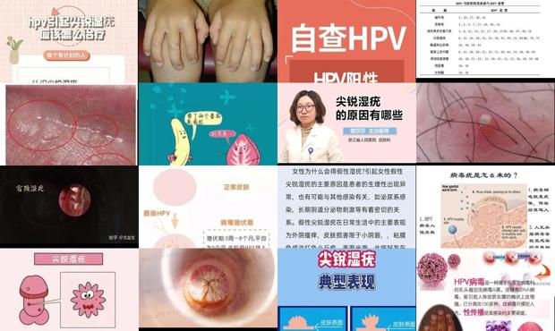 汕头尖锐湿尤是怎么引起的