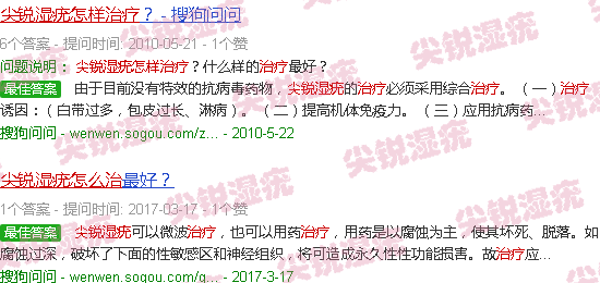 汕头龟头尖锐湿疣怎么治疗