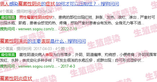 汕头男性霉菌性阴炎症状表现