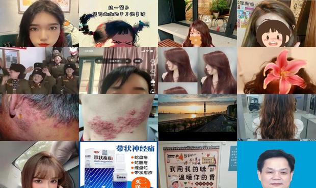 汕头染上疱疹一辈子*完了