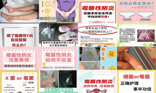 汕头男性霉菌性阴炎症状表现