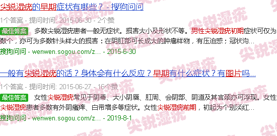 汕头男性尖锐湿疣图片早期图片