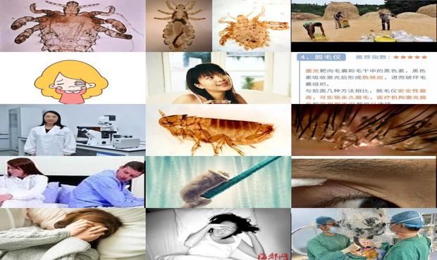 汕头男人下身有阴虱是从那里生出来的
