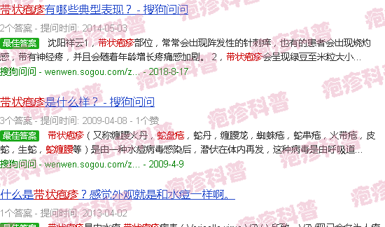 汕头带状疱疹图片