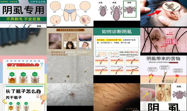 汕头男性阴虱是怎么得来的