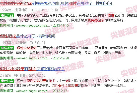 汕头假尖锐湿疣图片男