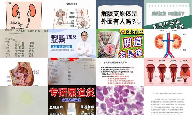汕头支原体尿道炎症状