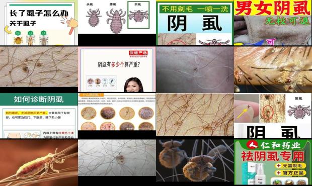 汕头阴虱怎么治疗