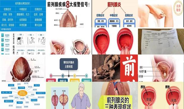 汕头男生前列腺炎症状