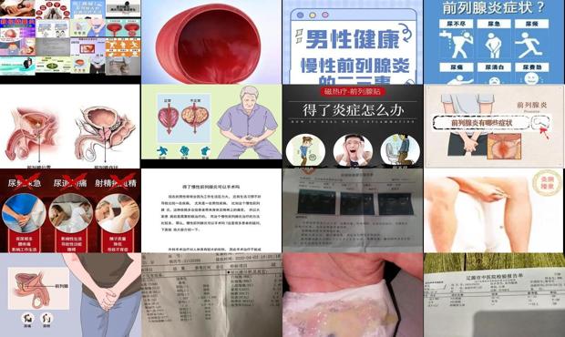 汕头得了慢性前列腺*完了