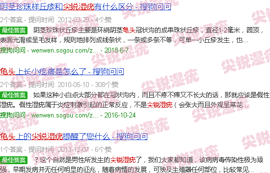 汕头龟头尖锐湿疣和龟头炎图片