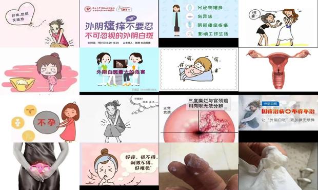 汕头外阴瘙痒会导致不孕吗