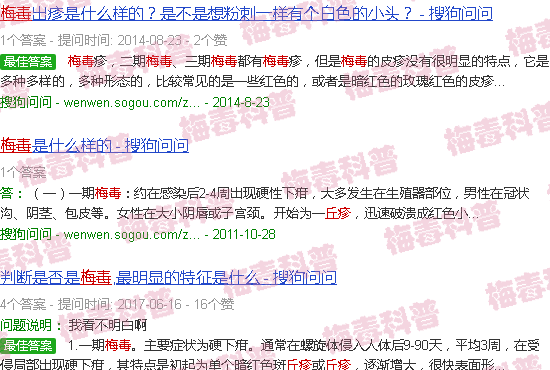 汕头早期梅毒小丘疹图片
