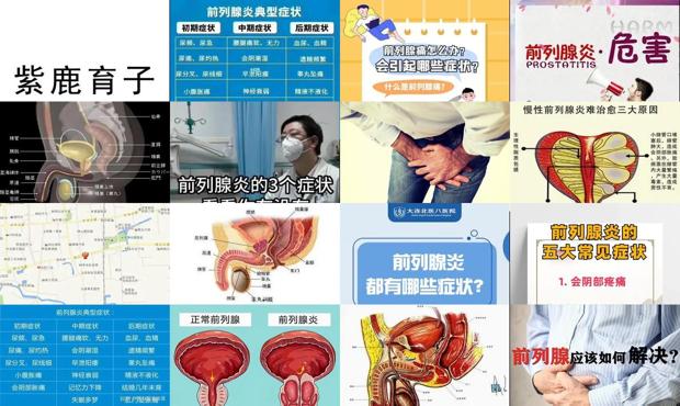 汕头男士前列腺炎症状有哪些