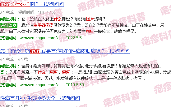 汕头生殖疱疹长什么样图片