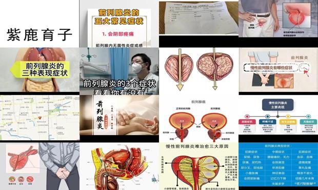 汕头关于前列腺炎症状照片