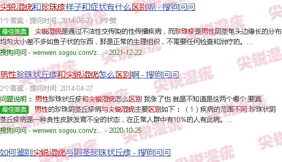 汕头男性珍珠疹与尖锐湿疣外观区别