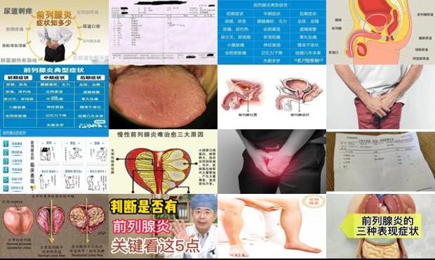 汕头男前列腺炎症状
