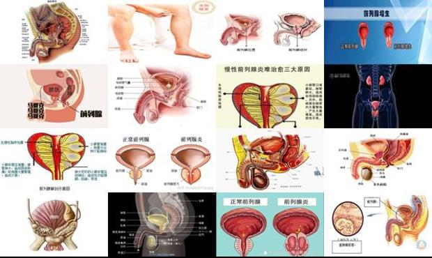 汕头前列腺炎是在哪里