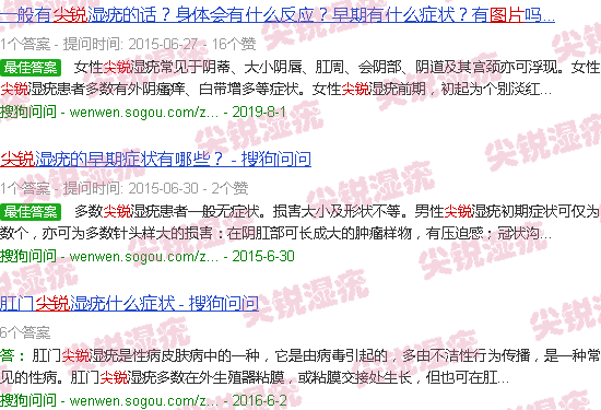 汕头尖锐湿疹图片