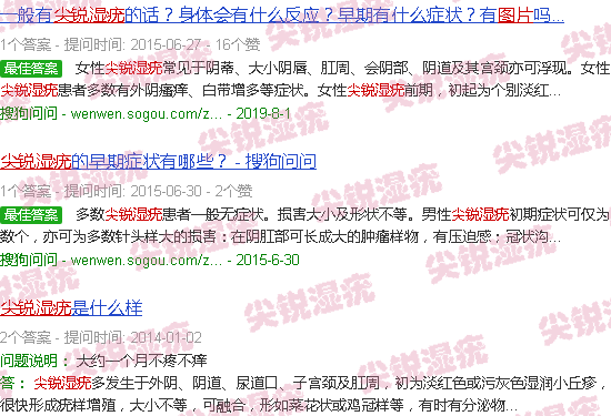 汕头尖锐湿疣百度图片