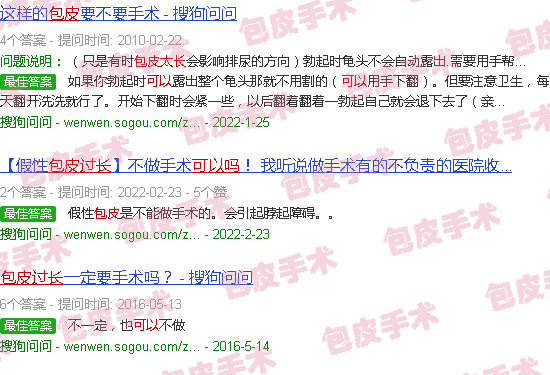 汕头包皮太长不割可以吗
