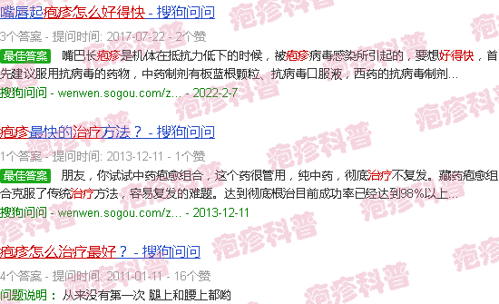 汕头疱疹怎么治疗好得快