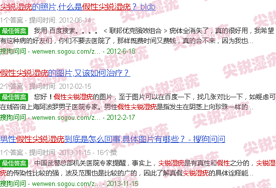 汕头假性尖锐湿疣高清图