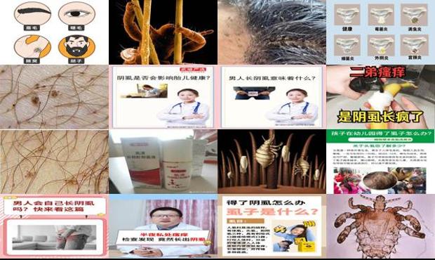 汕头男人长阴虱是什么原因造成的