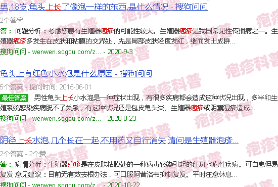 汕头阴茎上长疱疹