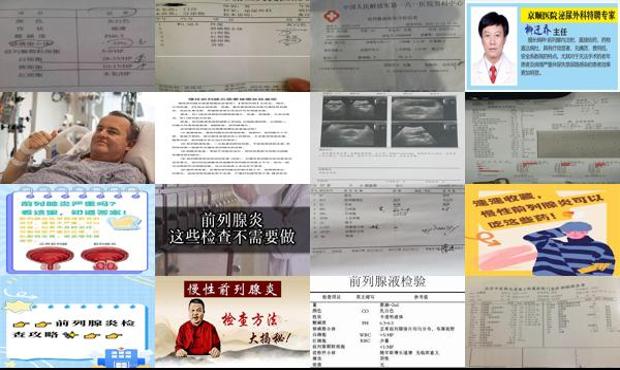 汕头前列腺炎楂查都做哪些