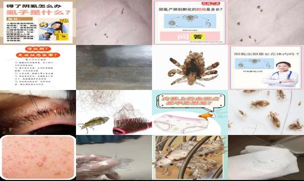 汕头阴虱是怎么得来的
