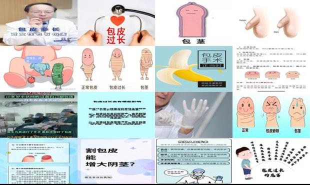 汕头包皮过长有必要割吗