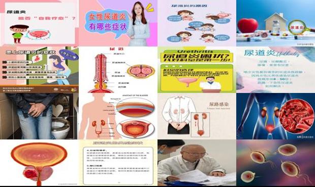 汕头严重尿道炎症状