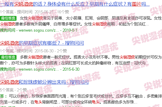 汕头龟头尖锐湿疣图片对照