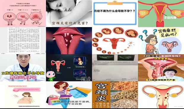 汕头宫颈糜烂会不会导致不孕