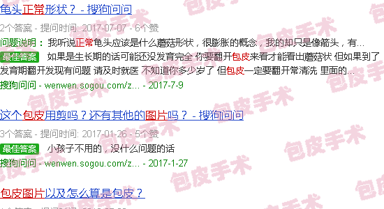 汕头男生正常包皮图片