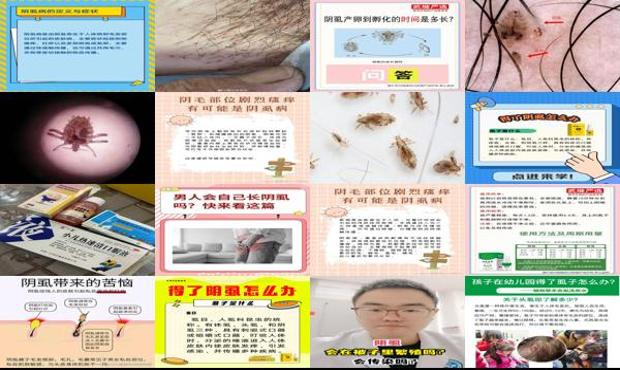 汕头阴虱怎么传染上的