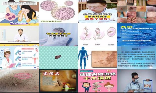 汕头男生怎么会得尖锐湿疣