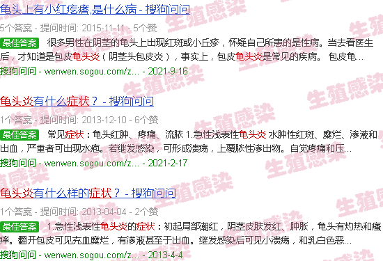 汕头*轻的龟头炎症状图片