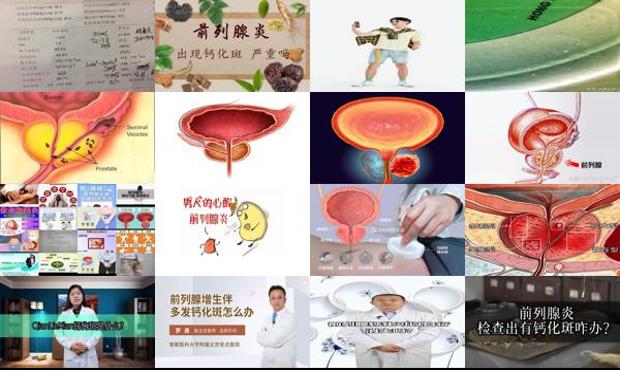 汕头前列腺钙斑化是怎么产生的