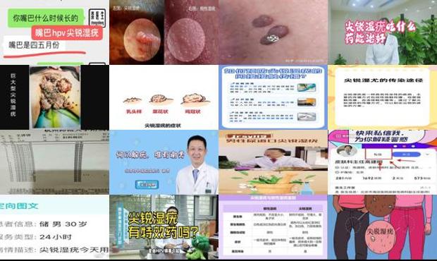 汕头尖锐湿疣在线医生咨询